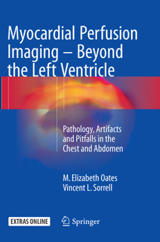 Paperback Myocardial Perfusion Imaging - Beyond the Left Ventricle: Pathology, Artifacts and Pitfalls in the Chest and Abdomen Book