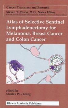 Hardcover Atlas of Selective Sentinel Lymphadenectomy for Melanoma, Breast Cancer and Colon Cancer Book