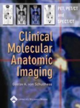 Hardcover Clinical Molecular Anatomic Imaging: PET, PET/CT, and SPECT/CT Book