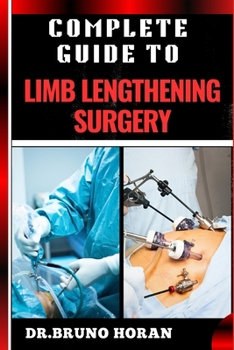 COMPLETE GUIDE TO LIMB LENGTHENING SURGERY: Essential Handbook To Modern Techniques, Recovery, And Best Practices For Optimal Results