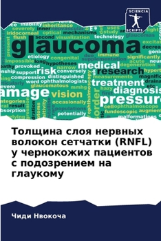 Paperback Толщина слоя нервных вол [Russian] Book