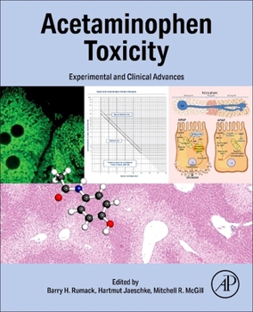 Paperback Acetaminophen Toxicity: Experimental and Clinical Advances Book