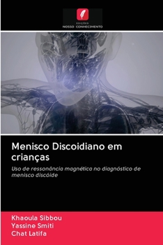 Paperback Menisco Discoidiano em crianças [Portuguese] Book