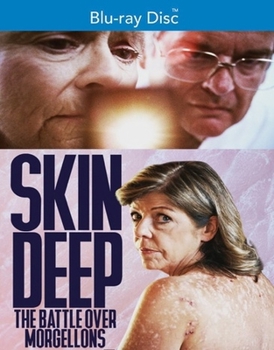 Blu-ray Skin Deep: The Battle Over Morgellons Book