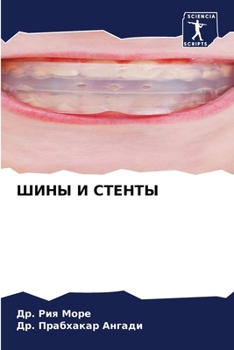 Paperback ШИНЫ И СТЕНТЫ [Russian] Book