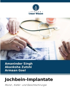 Paperback Jochbein-Implantate [German] Book