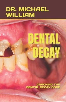 Paperback Dental Decay: Cracking the Dental Decay Code Book