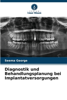Paperback Diagnostik und Behandlungsplanung bei Implantatversorgungen [German] Book