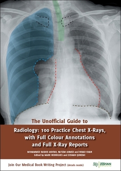 Paperback The Unofficial Guide to Radiology: 100 Practice Chest X Rays with Full Colour Annotations and Full X Ray Reports Book