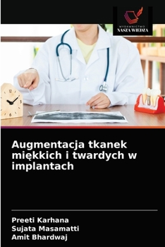 Paperback Augmentacja tkanek mi&#281;kkich i twardych w implantach [Polish] Book