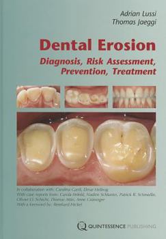 Hardcover Dental Erosion: Diagnosis, Risk Assessment, Prevention, Treatment Book