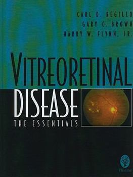 Hardcover Vitreoretinal Disease: The Essentials Book