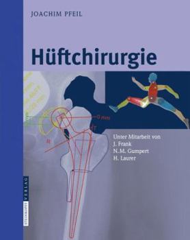 Spiral-bound Hüftchirurgie [German] Book