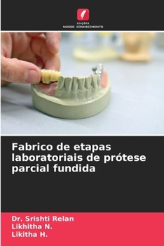 Fabrico de etapas laboratoriais de prótese parcial fundida (Portuguese Edition)