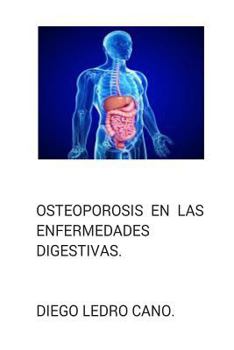 Paperback Osteoporosis en las enfermedades digestivas. [Spanish] Book