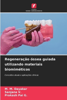 Regeneração óssea guiada utilizando materiais biomiméticos (Portuguese Edition)