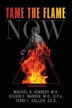 Paperback Tame the Flame Now Book