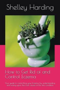Paperback How to get Rid of and Control Eczema: Your guide to controlling your Eczema, by understanding and acting upon the root causes of this skin condition Book
