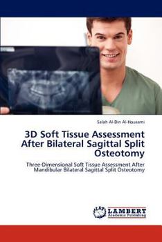 Paperback 3D Soft Tissue Assessment After Bilateral Sagittal Split Osteotomy Book