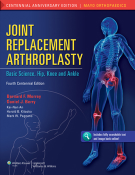 Hardcover Joint Replacement Arthroplasty: Basic Science, Hip, Knee, and Ankle Volume 2 Book