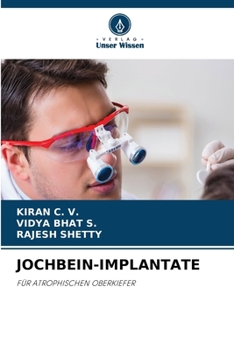 Paperback Jochbein-Implantate [German] Book