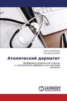 Paperback Atopicheskiy dermatit [Russian] Book