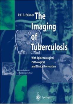 Hardcover The Imaging of Tuberculosis: With Epidemiological, Pathological and Clinical Correlation Book