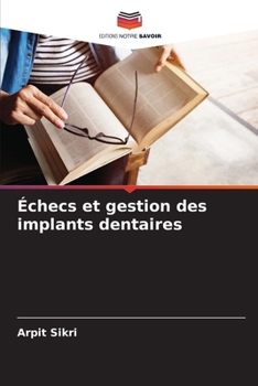 Paperback Échecs et gestion des implants dentaires [French] Book