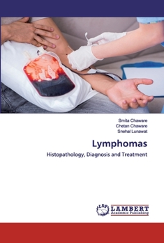 Paperback Lymphomas Book