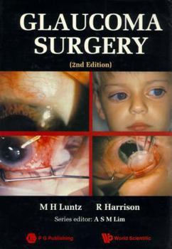 Hardcover Glaucoma Surgery (2nd Edition) Book