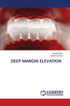 Deep Margin Elevation