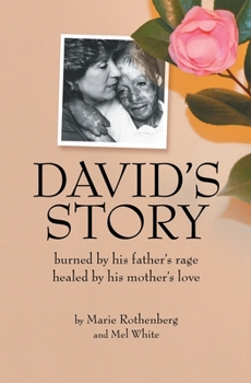 Paperback David's Story: Burned by his father's rage Healed by his mother's love Book