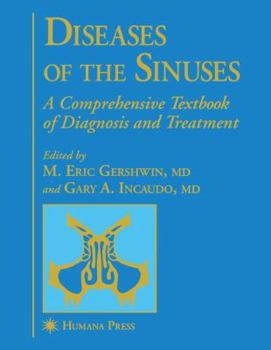 Paperback Diseases of the Sinuses: A Comprehensive Textbook of Diagnosis and Treatment Book