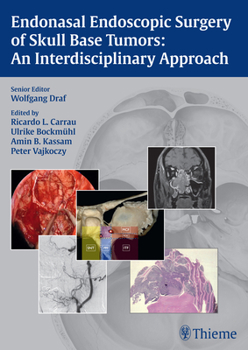 Hardcover Endonasal Endoscopic Surgery of Skull Base Tumors: An Interdisciplinary Approach Book
