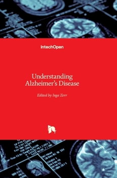 Hardcover Understanding Alzheimer's Disease Book