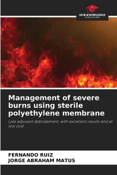Paperback Management of severe burns using sterile polyethylene membrane Book