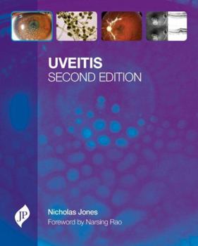 Hardcover Uveitis Book