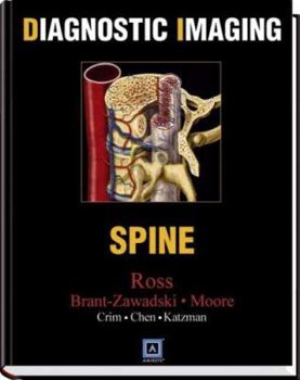 Hardcover Diagnostic Imaging: Spine Book