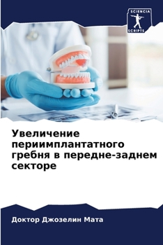 Paperback Увеличение периимплант&# [Russian] Book