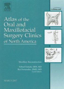 Hardcover Midface Reconstruction, an Issue of Atlas of the Oral and Maxillofacial Surgery Clinics: Volume 15-1 Book