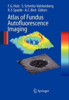 Paperback Atlas of Fundus Autofluorescence Imaging Book