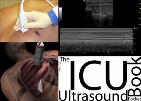 Spiral-bound The ICU Ultrasound Pocket Book