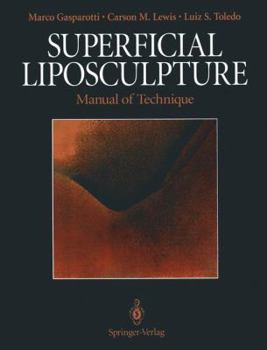 Hardcover Superficial Liposculpture: Manual of Technique Book