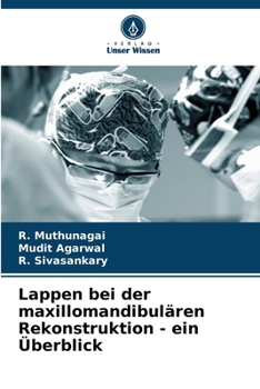Paperback Lappen bei der maxillomandibulären Rekonstruktion - ein Überblick [German] Book