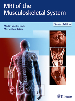 Hardcover MRI of the Musculoskeletal System Book