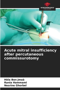 Paperback Acute mitral insufficiency after percutaneous commissurotomy Book