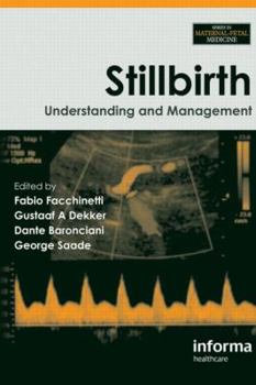 Hardcover Stillbirth: Understanding and Management Book
