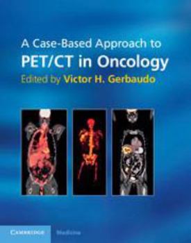 Electronics A Case-Based Approach to Pet/CT in Oncology Book