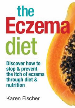 Paperback The Eczema Diet: Discover How to Stop and Prevent the Itch of Eczema Through Diet and Nutrition Book