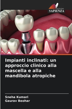 Impianti inclinati: un approccio clinico alla mascella e alla mandibola atropiche (Italian Edition)